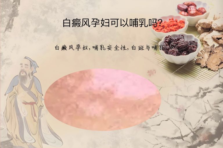 白癜风孕妇可以哺乳吗？”
