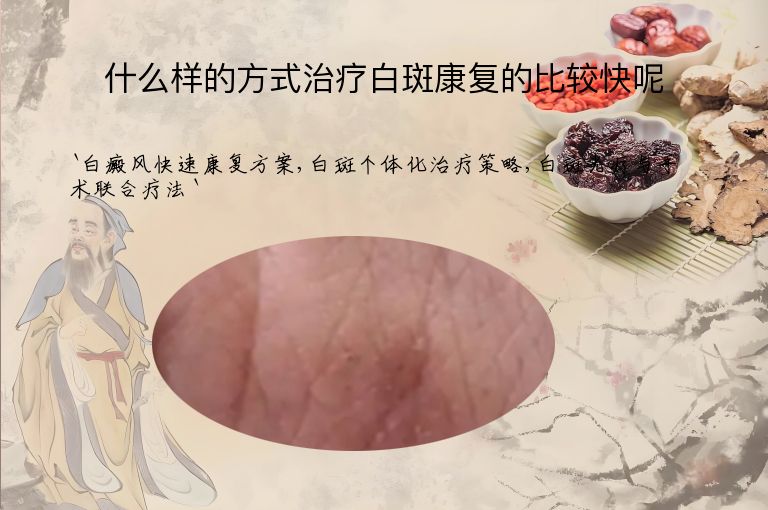什么样的方式治疗白斑康复的比较快呢
