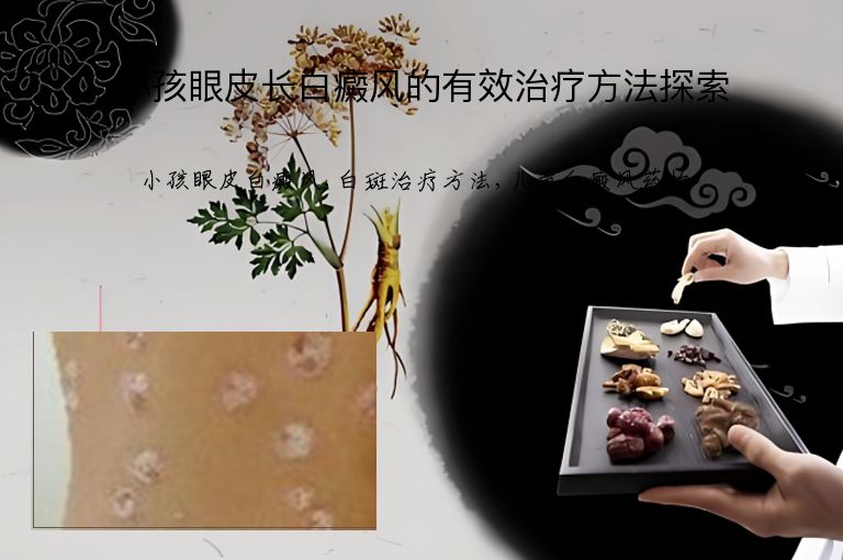 小孩眼皮长白癜风的有效治疗方法探索”