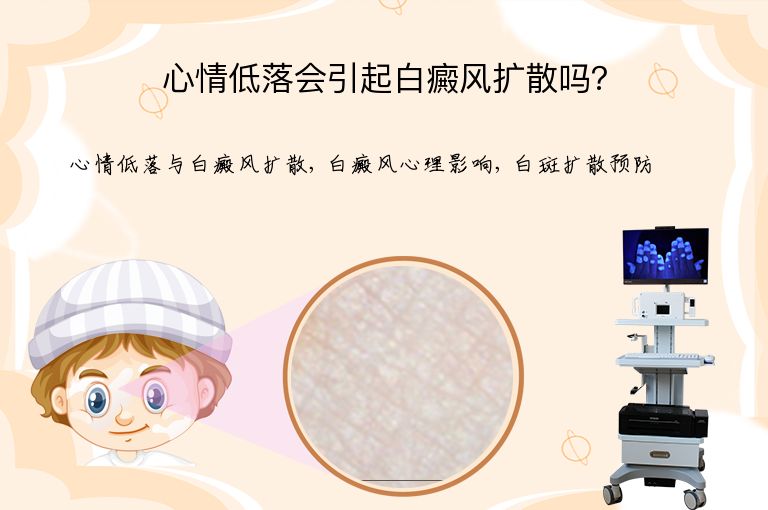 心情低落会引起白癜风扩散吗？”