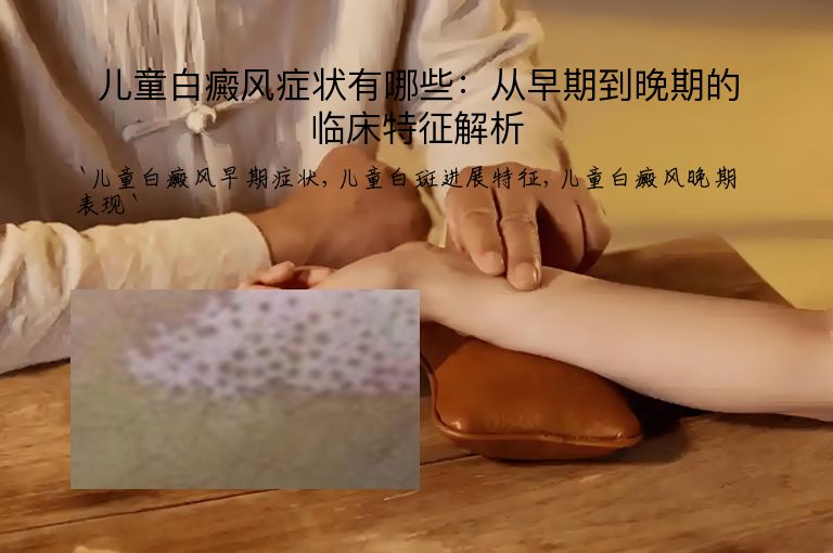 儿童白癜风症状有哪些：从早期到晚期的临床特征解析