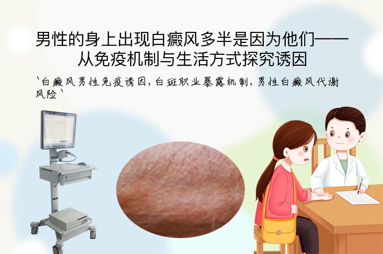 男性的身上出现白癜风多半是因为他们——从免疫机制与生活方式探究诱因