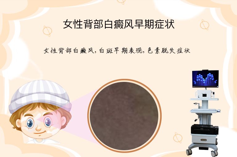 女性背部白癜风早期症状”
