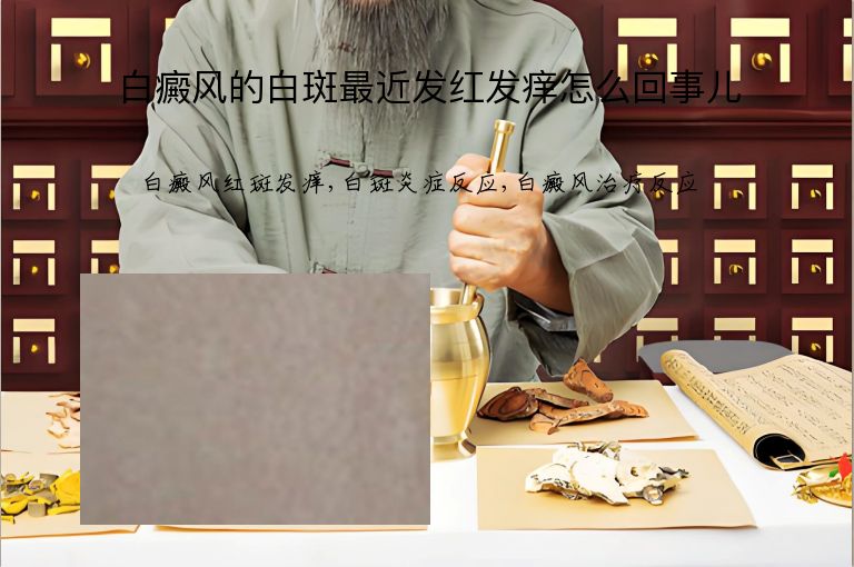 https://www.bdfsjzyy.com/d/file/p/23be47ba72fc6ab495ce8583b69e476e.jpeg