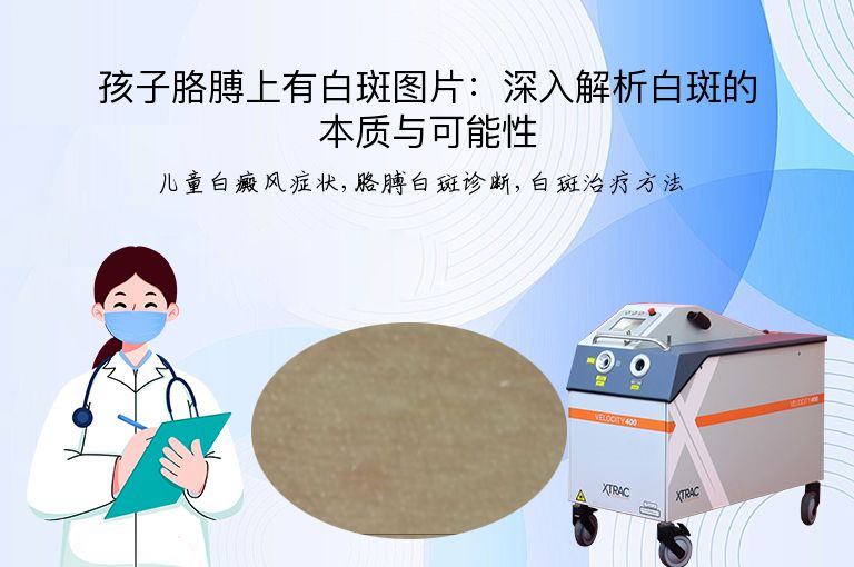 孩子胳膊上有白斑图片：深入解析白斑的本质与可能性”