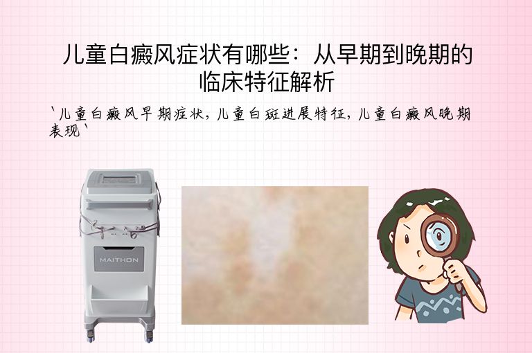 儿童白癜风症状有哪些：从早期到晚期的临床特征解析