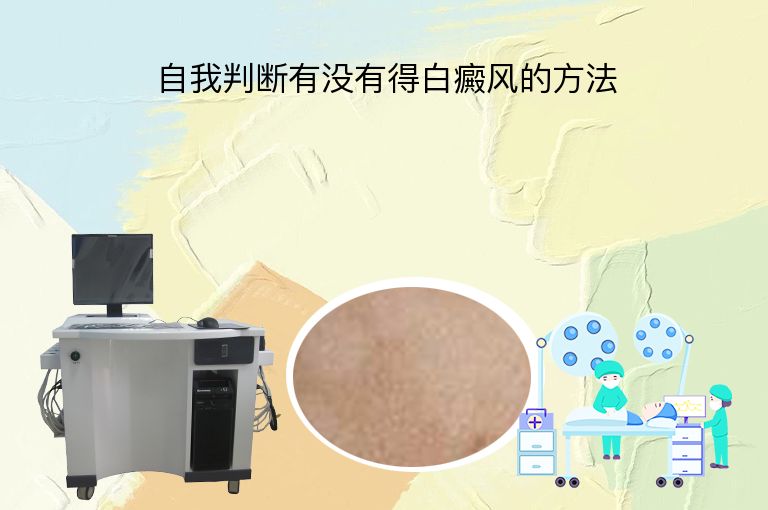 自我判断有没有得白癜风的方法”