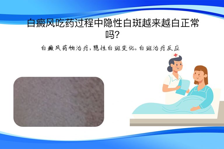 https://www.bdfsjzyy.com/d/file/p/0b59ffbea276ed42e509c267c80c90df.jpeg