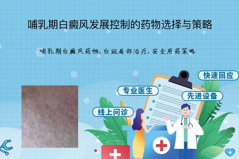 哺乳期白癜风发展控制的药物选择与策略”