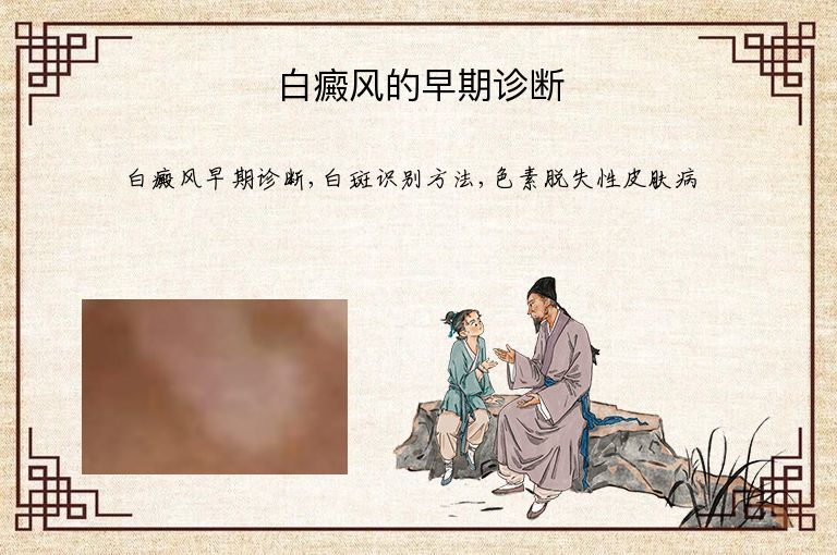 https://www.bdfsjzyy.com/d/file/p/1e885d58f0fc9e14eb026c8bc3478663.jpeg