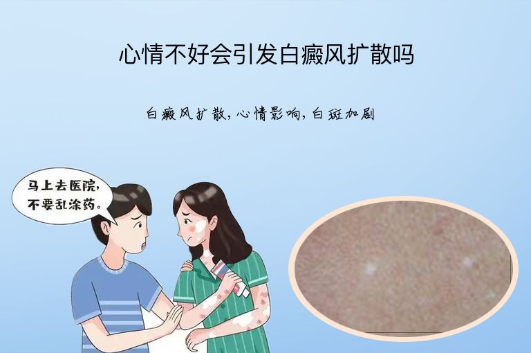 心情不好会引发白癜风扩散吗”