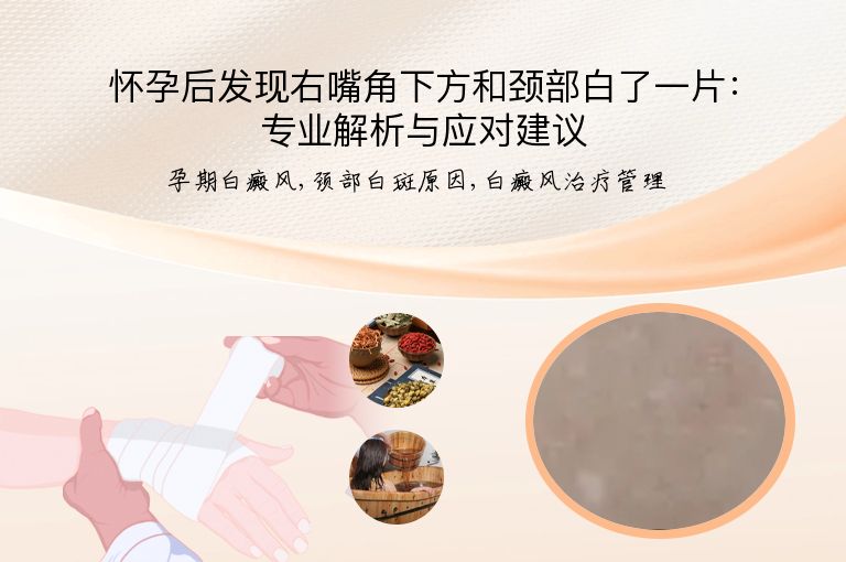 怀孕后发现右嘴角下方和颈部白了一片：专业解析与应对建议”