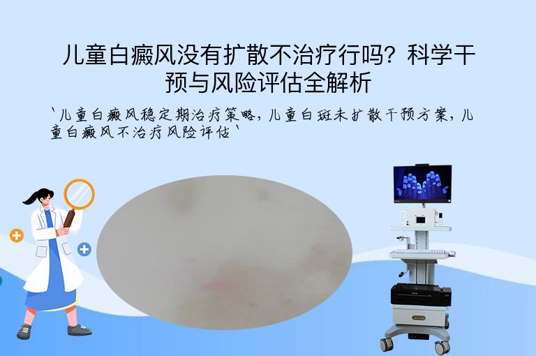 儿童白癜风没有扩散不治疗行吗？科学干预与风险评估全解析