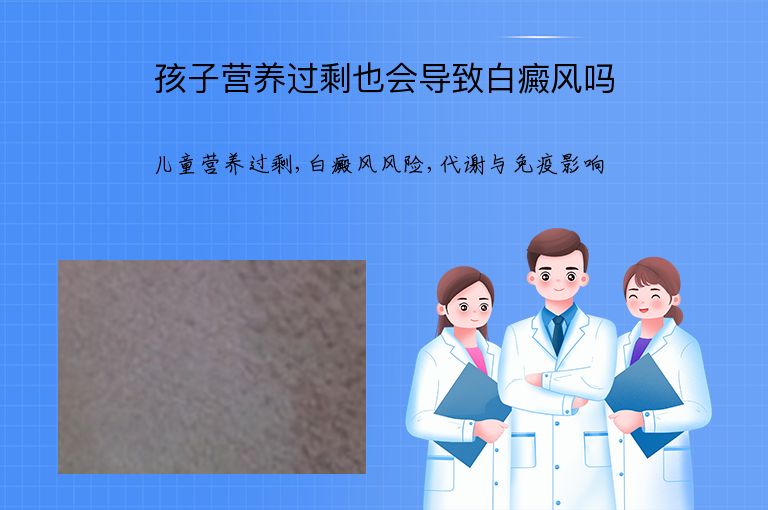 孩子营养过剩也会导致白癜风吗”