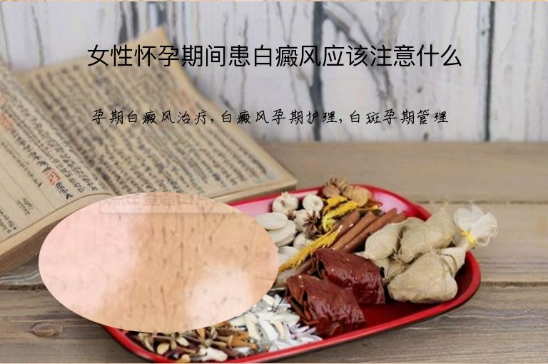 女性怀孕期间患白癜风应该注意什么”