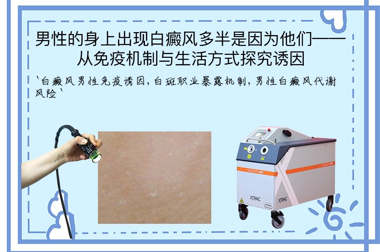 男性的身上出现白癜风多半是因为他们——从免疫机制与生活方式探究诱因