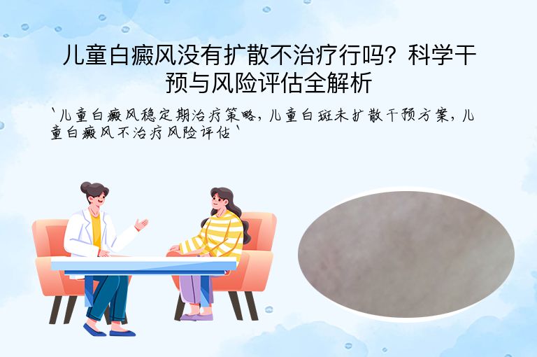 儿童白癜风没有扩散不治疗行吗？科学干预与风险评估全解析