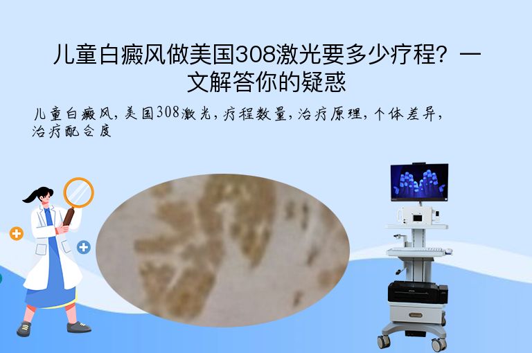 儿童白癜风做美国308激光要多少疗程?一文解答你的疑惑”