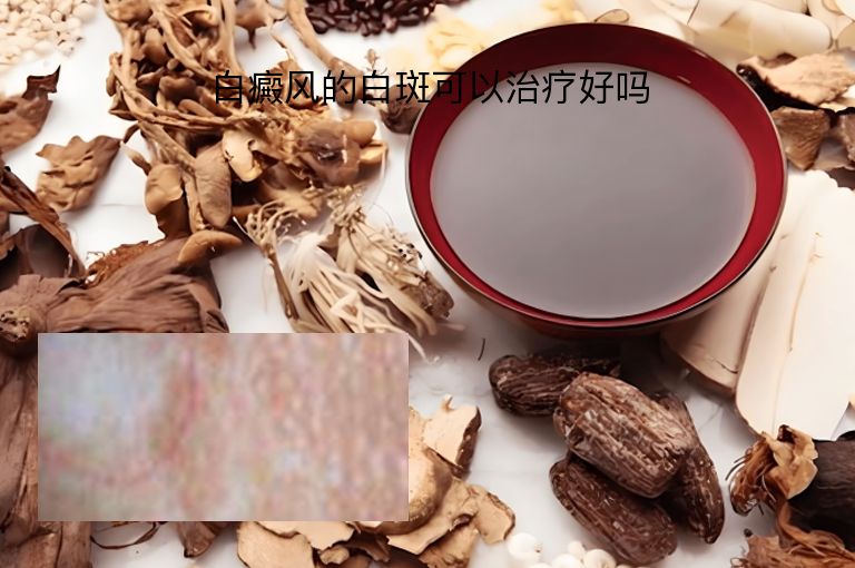 https://www.bdfsjzyy.com/d/file/p/5bded2ab4fbe6a490e3cc7799db5081d.jpeg