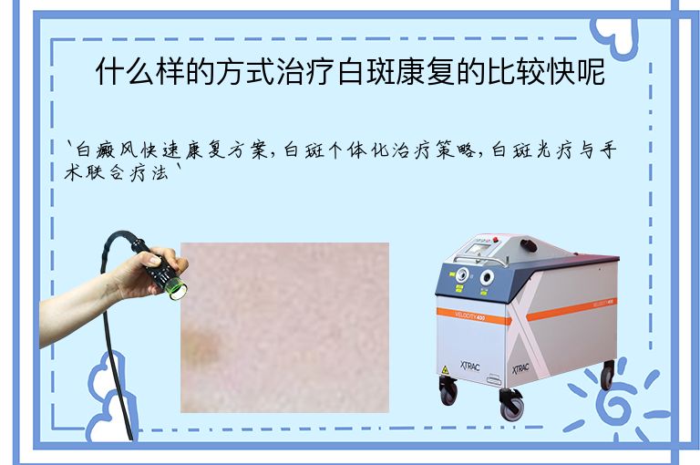 什么样的方式治疗白斑康复的比较快呢