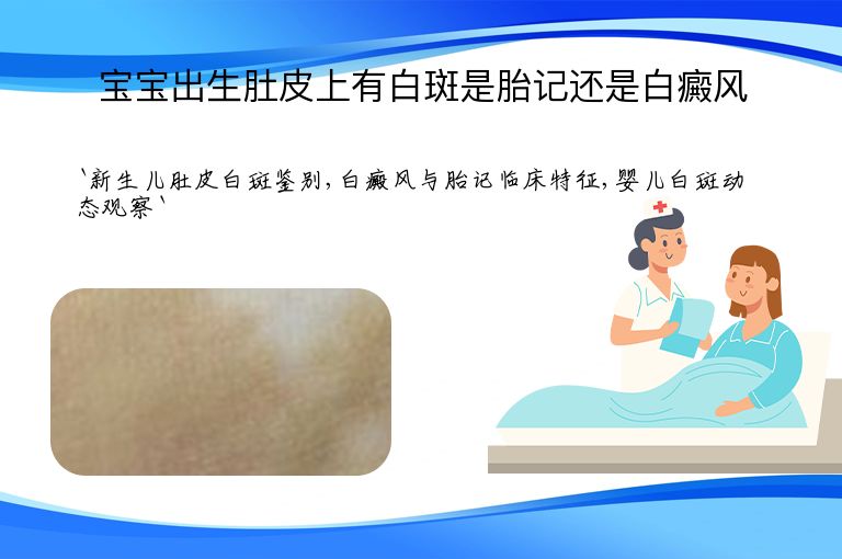 宝宝出生肚皮上有白斑是胎记还是白癜风”
