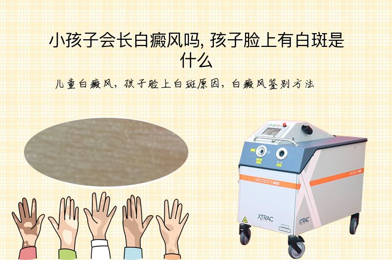 小孩子会长白癜风吗, 孩子脸上有白斑是什么”