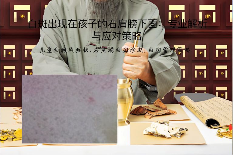 白斑出现在孩子的右肩膀下面：专业解析与应对策略”