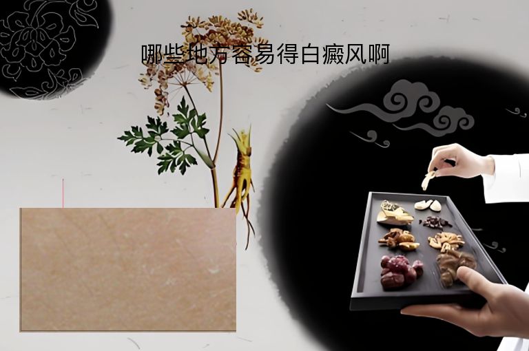 哪些地方容易得白癜风啊”