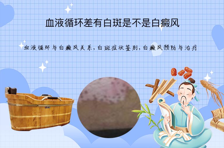血液循环差有白斑是不是白癜风”