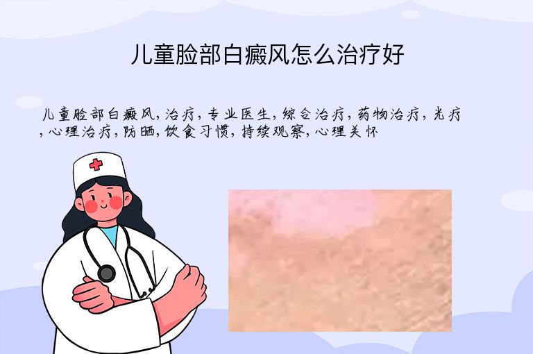 儿童脸部白癜风怎么治疗好”