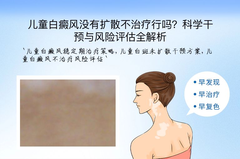 儿童白癜风没有扩散不治疗行吗?科学干预与风险评估全解析