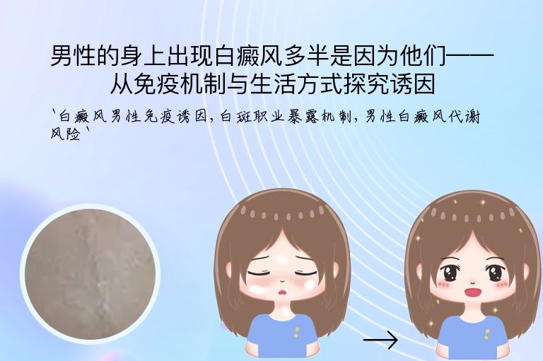 男性的身上出现白癜风多半是因为他们——从免疫机制与生活方式探究诱因