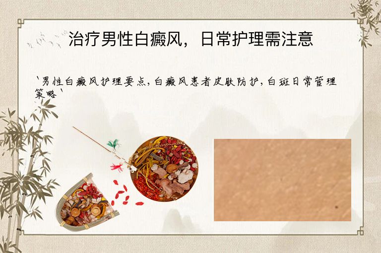 治疗男性白癜风，日常护理需注意