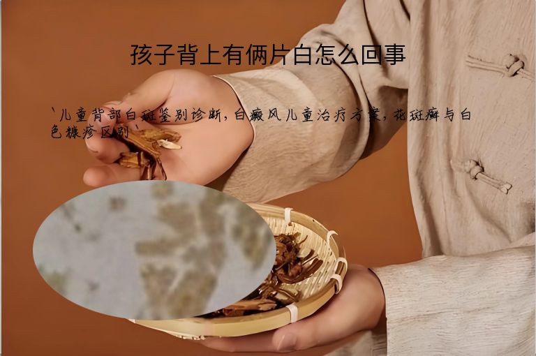 孩子背上有俩片白怎么回事