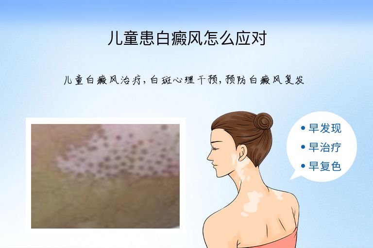 https://www.bdfsjzyy.com/d/file/p/94caadb4ba9b6c1d42a8b0a6e4f49f06.jpeg