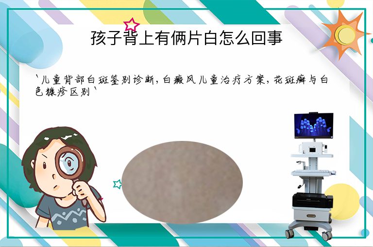 孩子背上有俩片白怎么回事