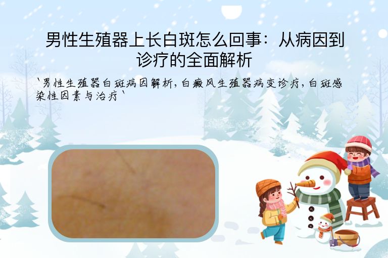 男性生殖器上长白斑怎么回事:从病因到诊疗的全面解析