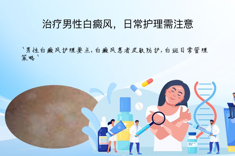 治疗男性白癜风，日常护理需注意