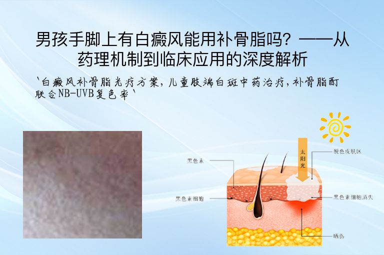 男孩手脚上有白癜风能用补骨脂吗?——从药理机制到临床应用的深度解析