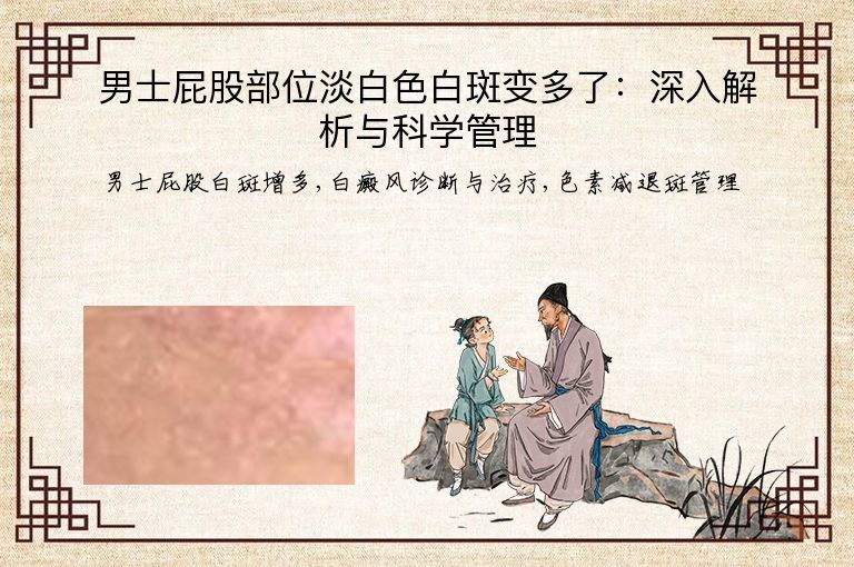 男士屁股部位淡白色白斑变多了:深入解析与科学管理”