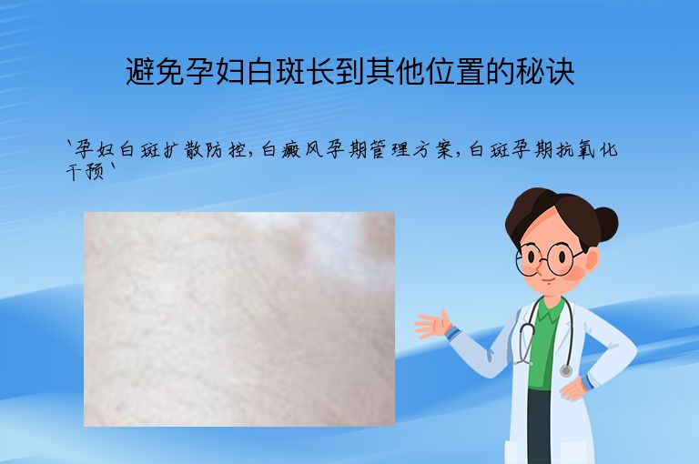避免孕妇白斑长到其他位置的秘诀