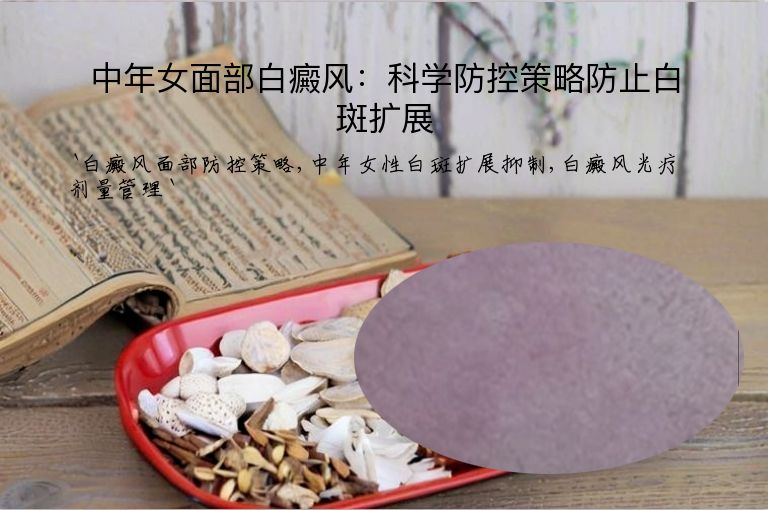 中年女面部白癜风：科学防控策略防止白斑扩展”