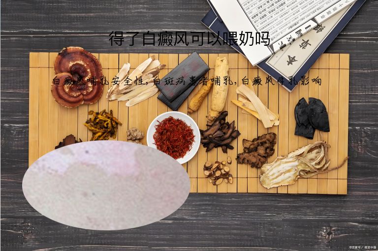 得了白癜风可以喂奶吗”