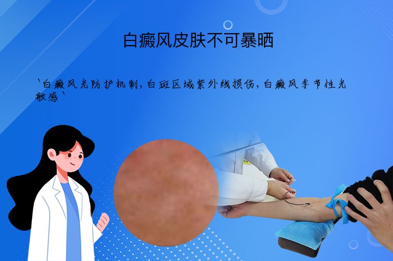白癜风皮肤不可暴晒