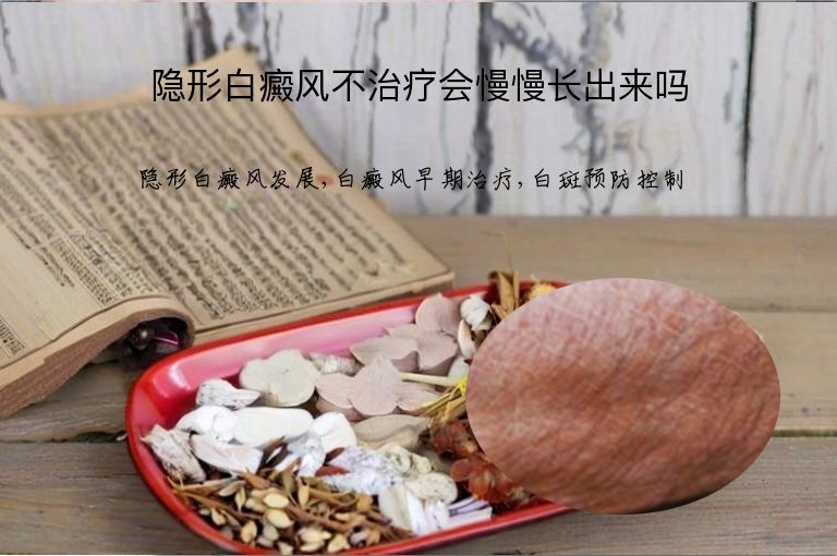 隐形白癜风不治疗会慢慢长出来吗”