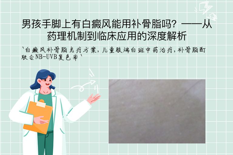 男孩手脚上有白癜风能用补骨脂吗？——从药理机制到临床应用的深度解析