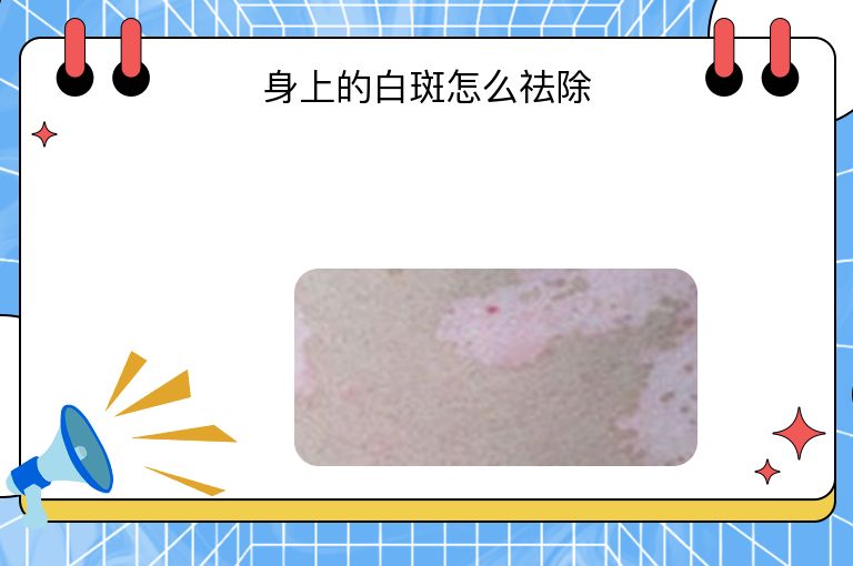 https://www.bdfsjzyy.com/d/file/p/fd2e45fcaea04b3cf77cd6bb6bc67f29.jpeg