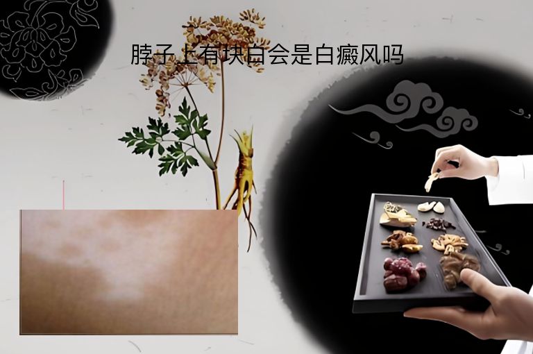脖子上有块白会是白癜风吗