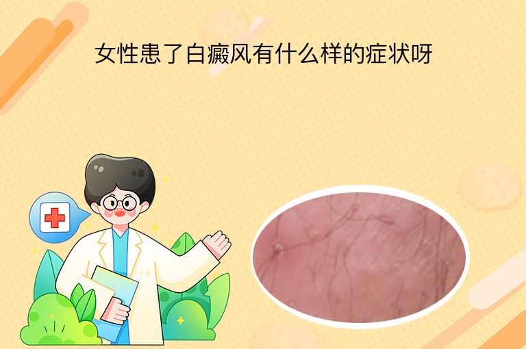 女性患了白癜风有什么样的症状呀