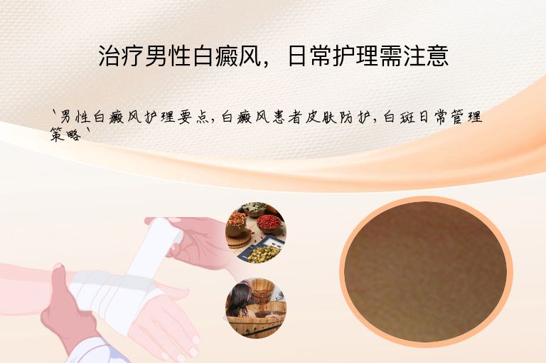 治疗男性白癜风,日常护理需注意